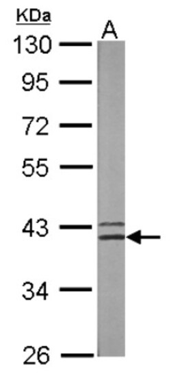Spermine synthase Antibody, Novus Biologicals 0.1mL; Unlabeled:Antibodies,