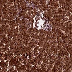 Carboxylesterase 1/CES1 Antibody, Novus Biologicals:Antibodies:Primary
