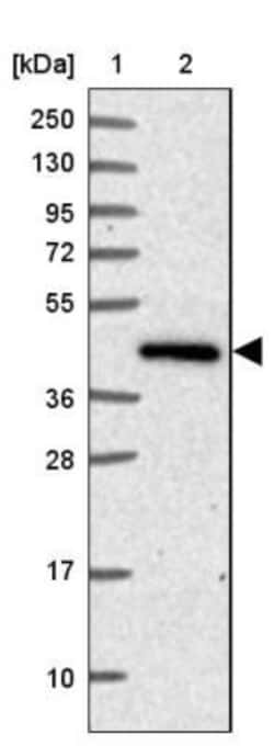 SPESP1 Antibody, Novus Biologicals 25ul | Buy Online | Novus Biologicals | Fisher Scientific