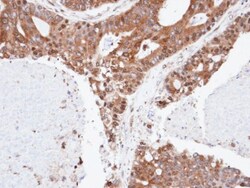 SPFH2 Antibody, Novus Biologicals 0.1mL; Unlabeled:Antibodies, Polyclonal