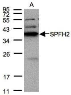 SPFH2 Antibody, Novus Biologicals 0.1mL; Unlabeled:Antibodies, Polyclonal