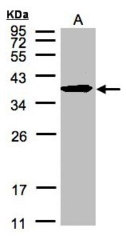 SPFH2 Antibody, Novus Biologicals 0.1mL; Unlabeled:Antibodies, Polyclonal