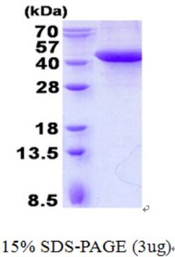 Novus Biologicals&trade;&nbsp;Recombinant Human SPFH2 His Protein