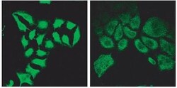SPG20 Antibody, Novus Biologicals 0.1mg; Unlabeled:Antibodies, Polyclonal