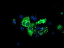 SPG7 Antibody (OTI1C1), Novus Biologicals 0.1mL; Unlabeled:Antibodies,