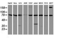 SPG7 Antibody (OTI1C1), Novus Biologicals 0.1mL; Unlabeled:Antibodies,