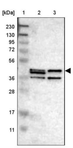 Sphingomyelin Synthase 2 Antibody, Novus Biologicals 25 &mu;L, Unlabeled:Antibodies,