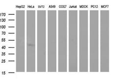 Sphingosine Kinase 1/SPHK1 Antibody (OTI1A6), Novus Biologicals 0.1mL;