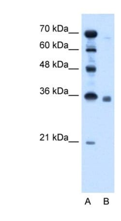 Sphingosine 1 phosphate phosphatase 2 Antibody, Novus Biologicals 0.1mg;