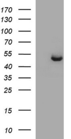 Sphingosine Kinase 1/SPHK1 Antibody (OTI1A6), Novus Biologicals 0.1mL;