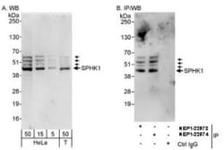 Sphingosine Kinase 1/SPHK1 Antibody, Novus Biologicals:Antibodies:Primary