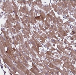 SPHKAP Antibody, Novus Biologicals 0.1mL; Unlabeled:Antibodies, Polyclonal