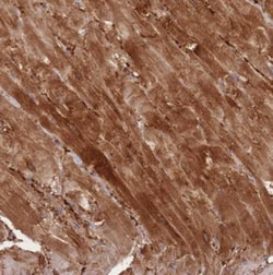 SPHKAP Antibody, Novus Biologicals:Antibodies:Primary Antibodies