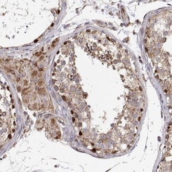 SPICE1 Antibody, Novus Biologicals:Antibodies:Primary Antibodies