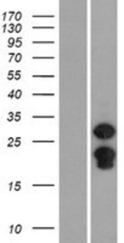 Novus Biologicals&trade;&nbsp;SPIN2B Overexpression Lysate