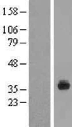 Novus Biologicals&trade;&nbsp;SPIN4 Overexpression Lysate