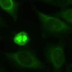 Novus Biologicals™ Spindle Bipolarism Antibody Pack