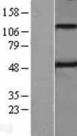 Novus Biologicals&trade;&nbsp;Spinesin Overexpression Lysate