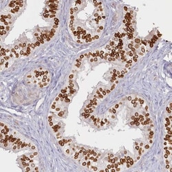 SPINK13 Antibody, Novus Biologicals:Antibodies:Primary Antibodies