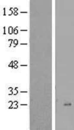 Novus Biologicals&trade;&nbsp;SPINK13 Overexpression Lysate