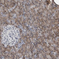 SPINK1 Antibody, Novus Biologicals:Antibodies:Primary Antibodies