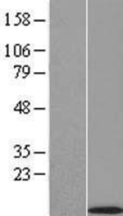 Novus Biologicals&trade;&nbsp;SPINK4 Overexpression Lysate