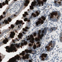 SPINK4 Antibody, Novus Biologicals 25 &mu;L, Unlabeled:Antibodies, Polyclonal