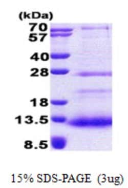 Novus Biologicals&trade;&nbsp;Recombinant Human SPINK7 His Protein