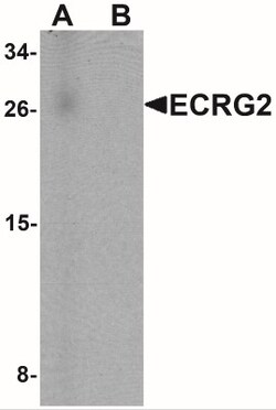 SPINK7 Antibody - BSA Free, Novus Biologicals 0.1mg; Unlabeled:Antibodies,