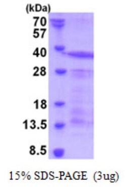 Novus Biologicals Recombinant Human CD43/Sialophorin His Protein 0.1 mg | Buy Online | Novus Biologicals&trade; | Fisher Scientific