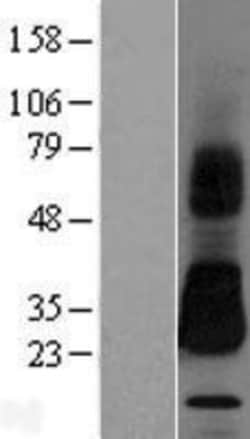 Novus Biologicals™ HAI-2/SPINT2 Overexpression Lysate