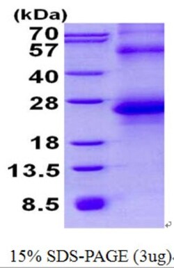 Novus Biologicals&trade;&nbsp;Recombinant Human HAI-2/SPINT2 His Protein