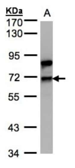 Splicing Factor 1 Antibody, Novus Biologicals 0.1mL; Unlabeled:Antibodies,