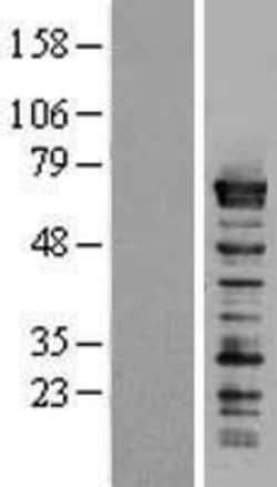 Novus Biologicals&trade;&nbsp;Splicing Factor 1 Overexpression Lysate