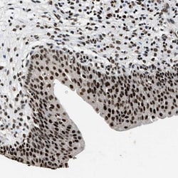 LAD1 Antibody, Novus Biologicals:Antibodies:Primary Antibodies