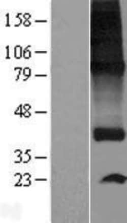 Novus Biologicals&trade;&nbsp;SPNS1 Overexpression Lysate