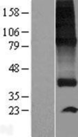 Novus Biologicals&trade;&nbsp;SPNS1 Overexpression Lysate