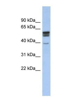 SPNS2 Antibody, Novus Biologicals 0.05mg; Unlabeled:Antibodies, Polyclonal