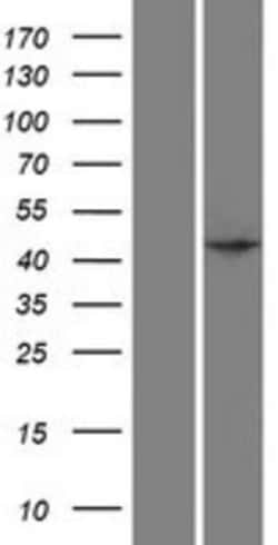 Novus Biologicals&trade;&nbsp;SPO11 Overexpression Lysate