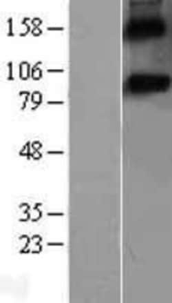 Novus Biologicals&trade;&nbsp;F-Spondin/SPON1 Overexpression Lysate