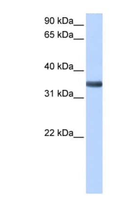 Mindin/Spondin-2 Antibody, Novus Biologicals:Antibodies:Primary Antibodies
