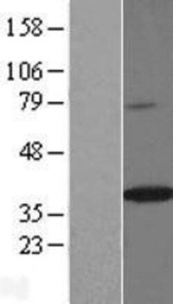 Novus Biologicals&trade;&nbsp;Mindin/Spondin-2 Overexpression Lysate