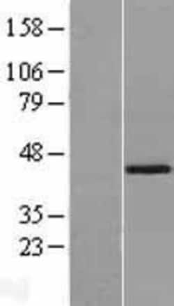 Novus Biologicals&trade;&nbsp;SPOP Overexpression Lysate