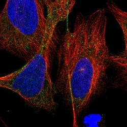 SPPL2a Antibody, Novus Biologicals 0.1mL; Unlabeled:Antibodies, Polyclonal