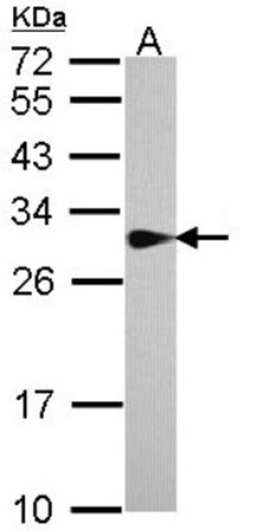 SPR Antibody, Novus Biologicals 0.1mg; Unlabeled:Antibodies, Polyclonal