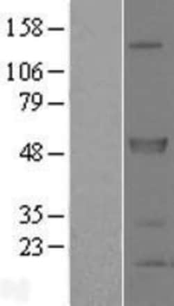 Novus Biologicals&trade;&nbsp;SPRED2 Overexpression Lysate