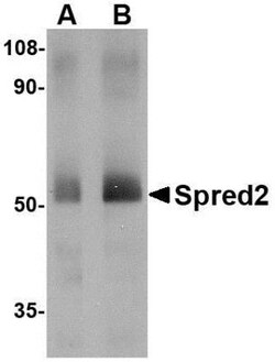SPRED2 Antibody - BSA Free, Novus Biologicals 0.1mg; Unlabeled:Antibodies,