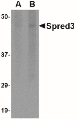 SPRED3 Antibody - BSA Free, Novus Biologicals 0.1mg; Unlabeled:Antibodies,