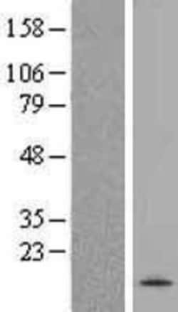 Novus Biologicals™ SPRN Overexpression Lysate