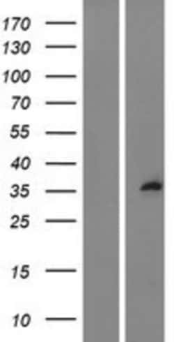Novus Biologicals&trade;&nbsp;SPRY1 Overexpression Lysate